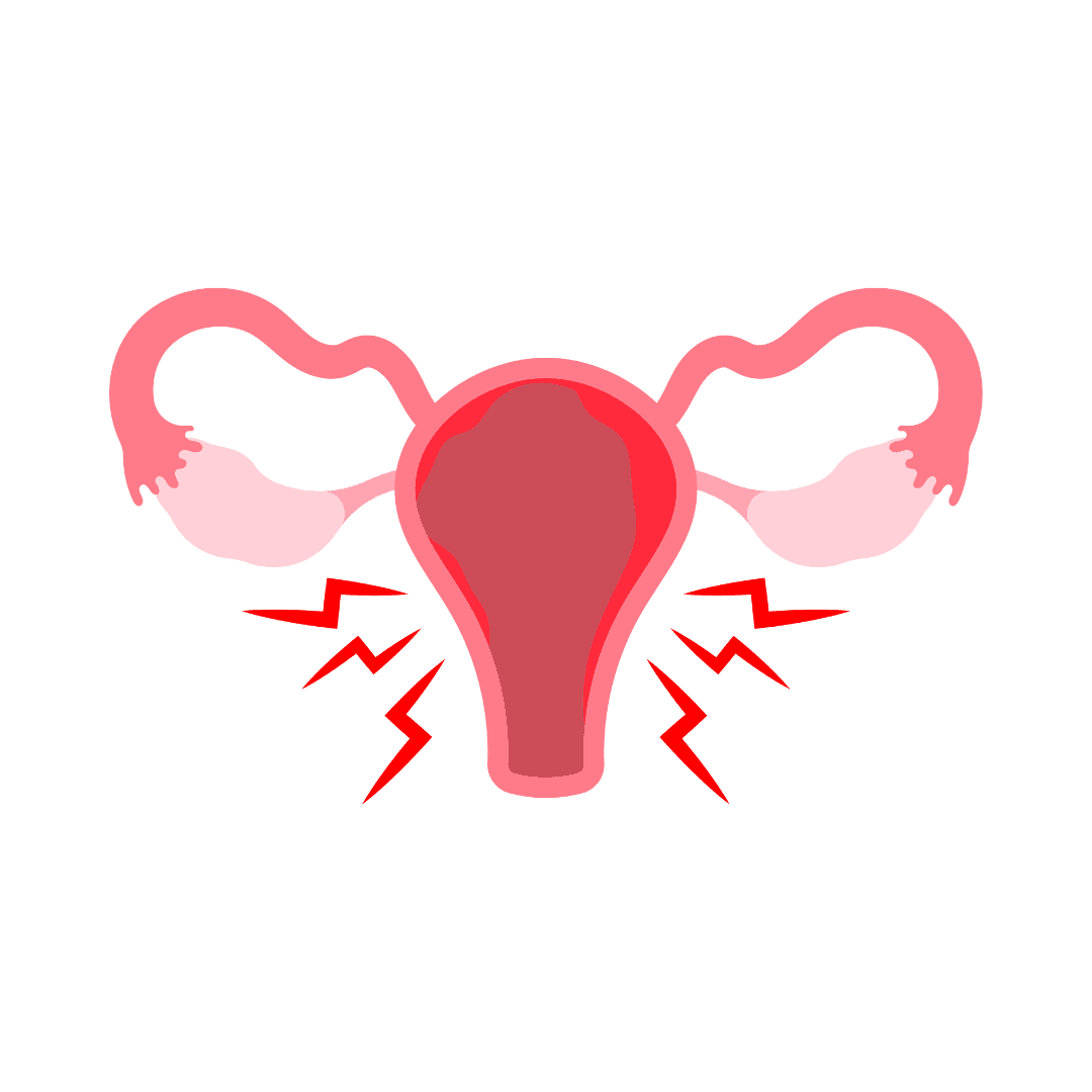 Endometriose
