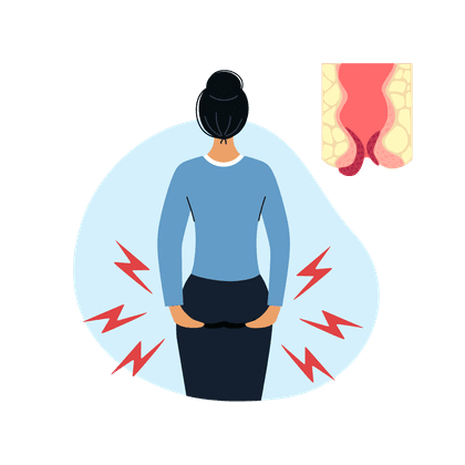 Hämorrhoiden